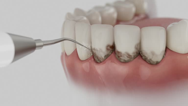 Trusted Root Canal Treatment service in High Bridge, WA - Dentist Open Now
